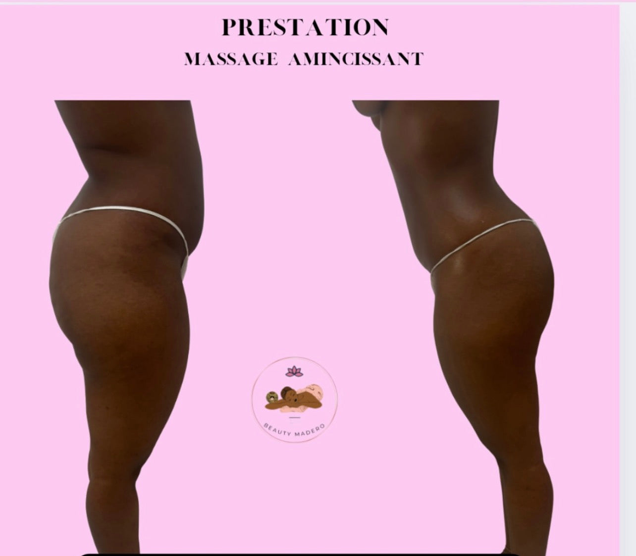 Acompte – Séance Amincissante Beauty Madero Guadeloupe 🇬🇵