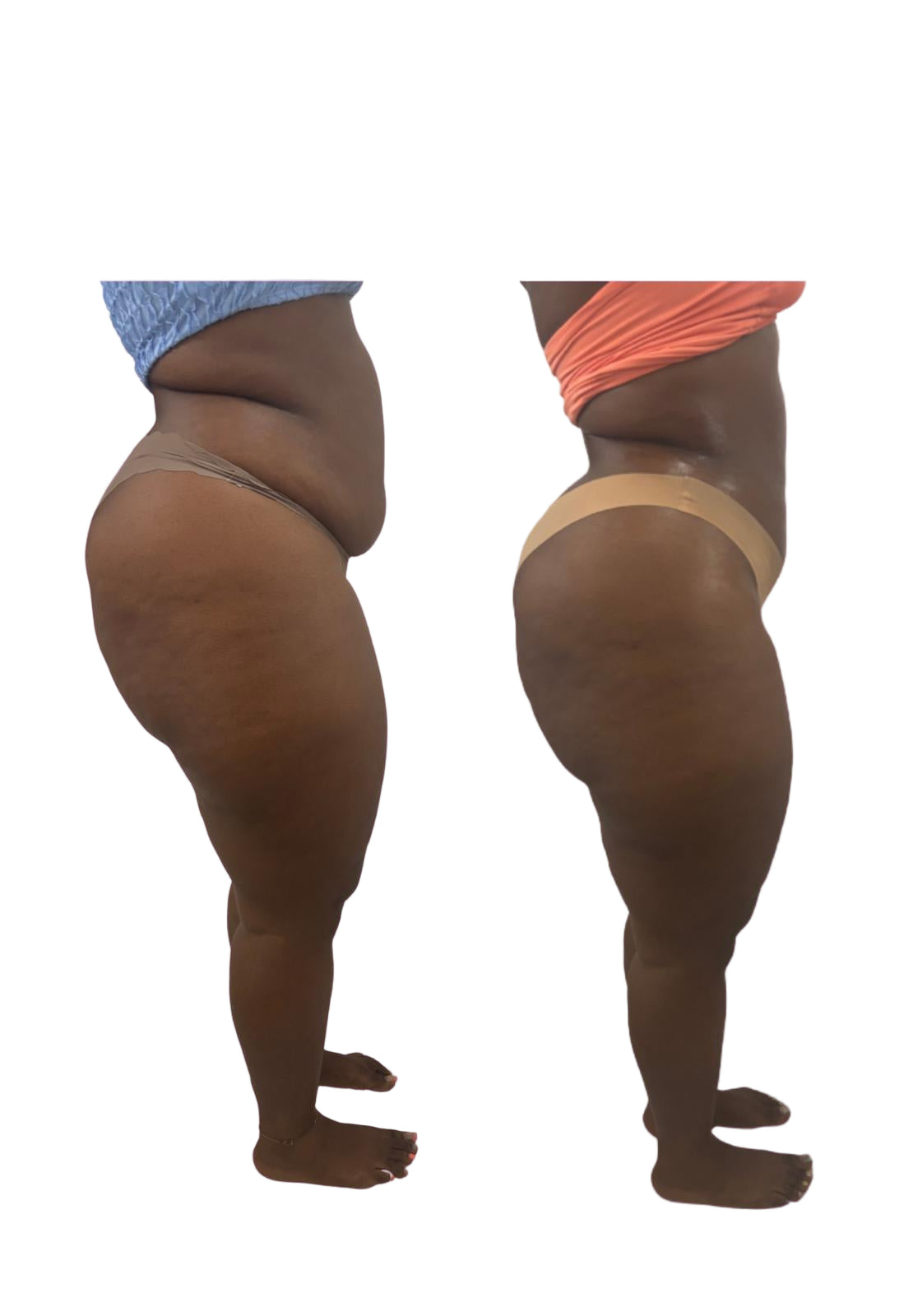 Acompte Dissolution – Martinique & Guadeloupe